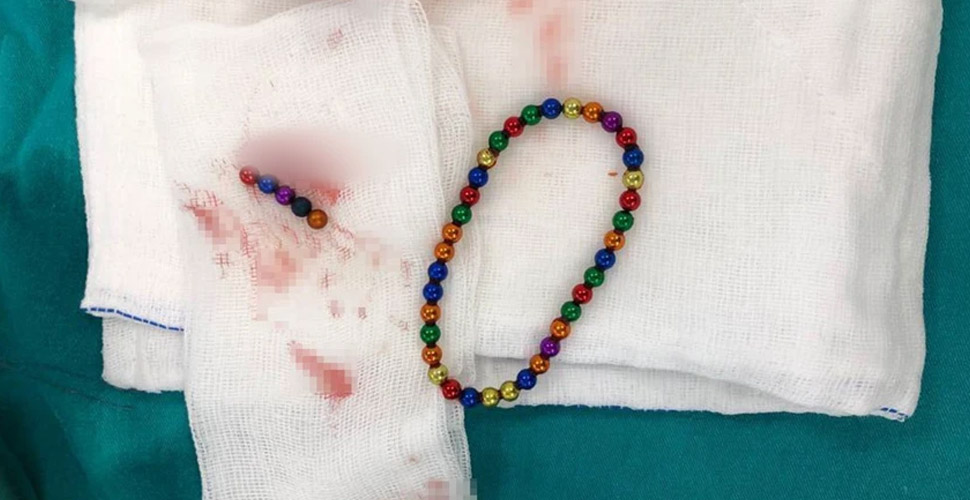 Karın ağrısıyla hastaneye giden çocuğun midesinden 42 adet mıknatıs çıktı