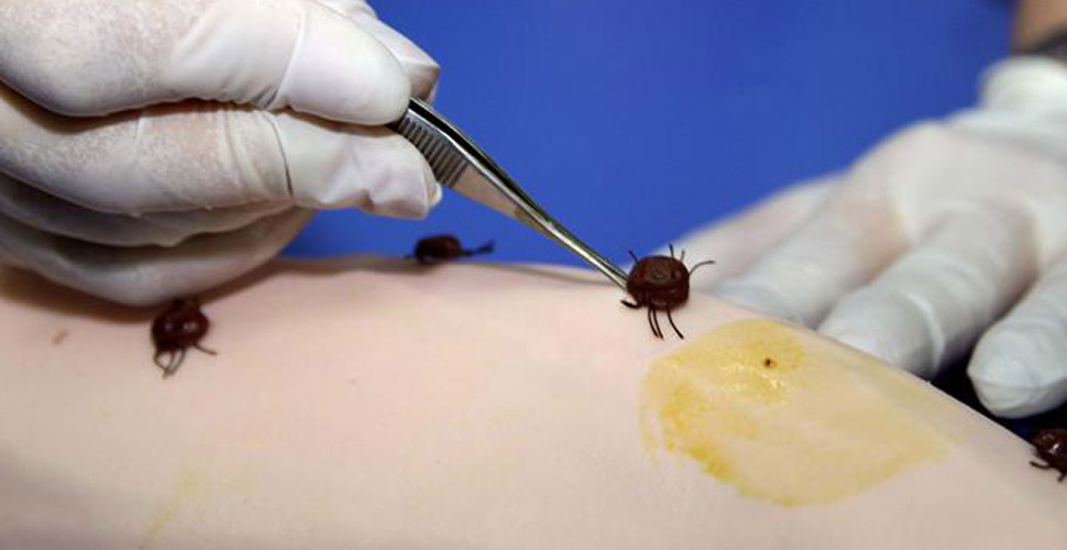 Koronadan kaçarken keneye tutulduk!