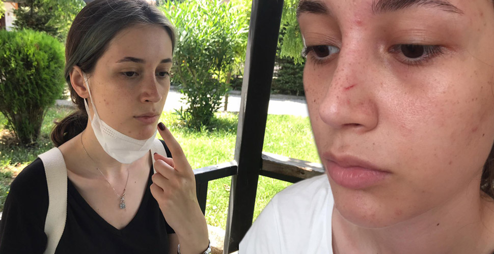 Şort giydiği için darp edilen ODTÜ'lü Beril yaşadığı dehşeti anlattı: Çığlıklarımı duyan koşup geldi