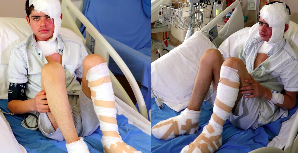 Elektrik akımına kapılan Ebubekir'in ayak tabanları patladı