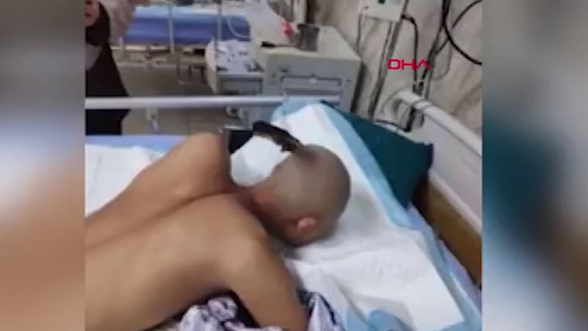 Çinli adam kafasına saplı bıçakla rahat tavırlar sergiledi