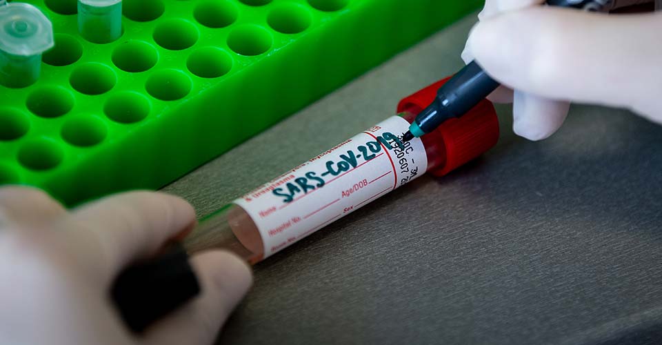 Kağızman Belediyesi'nde Kovid-19 alarmı!