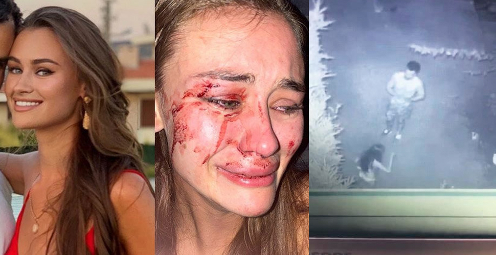 Ukraynalı model Daria Kyryliuk'un darp soruşturmasında yeni bilirkişi raporu