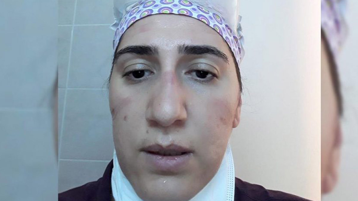 24 saat maske ve gözlük takan sağlık çalışanının yüzü yara oldu