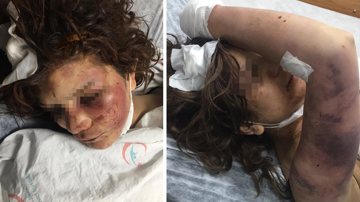 5 gün boyunca odaya kilitlediği eşini zincirle dövüp, tırnaklarını kerpetenle çekti!