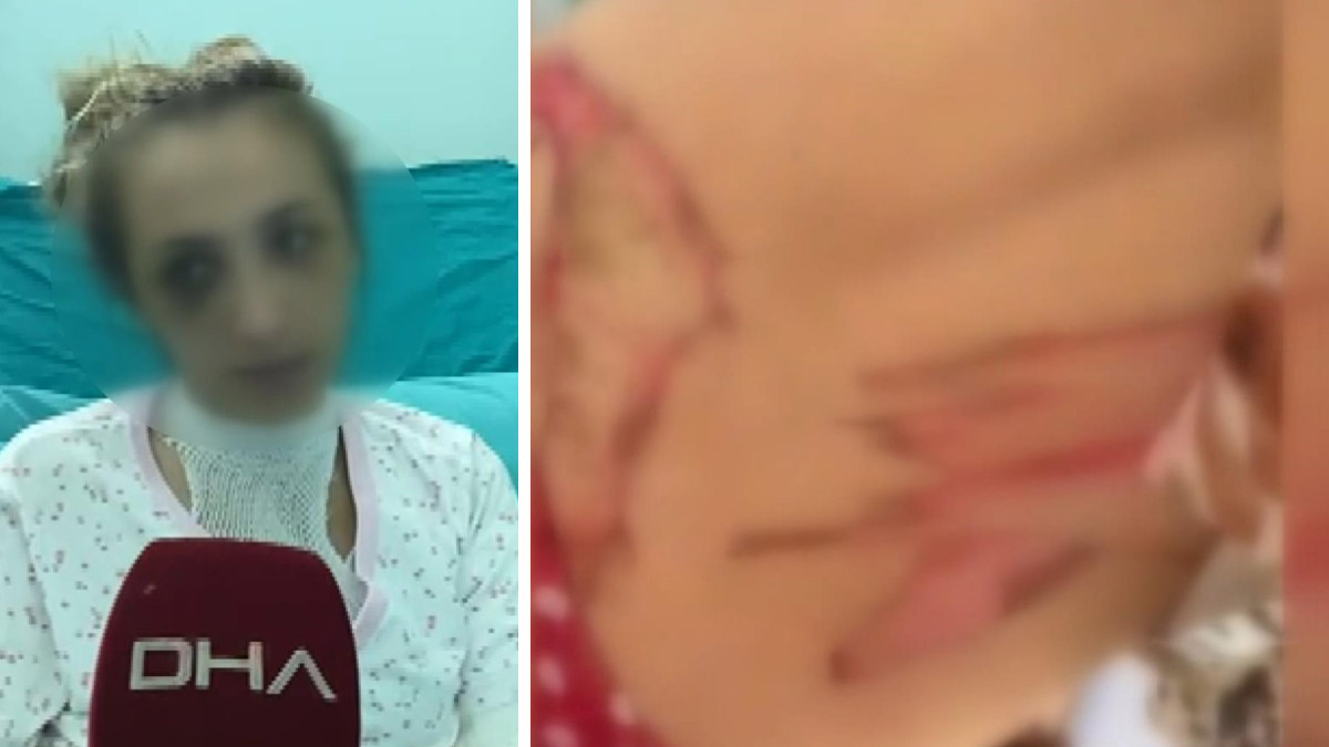 Darp ettiği eşine bütün gece ısıtılmış bıçakla işkence yaptı