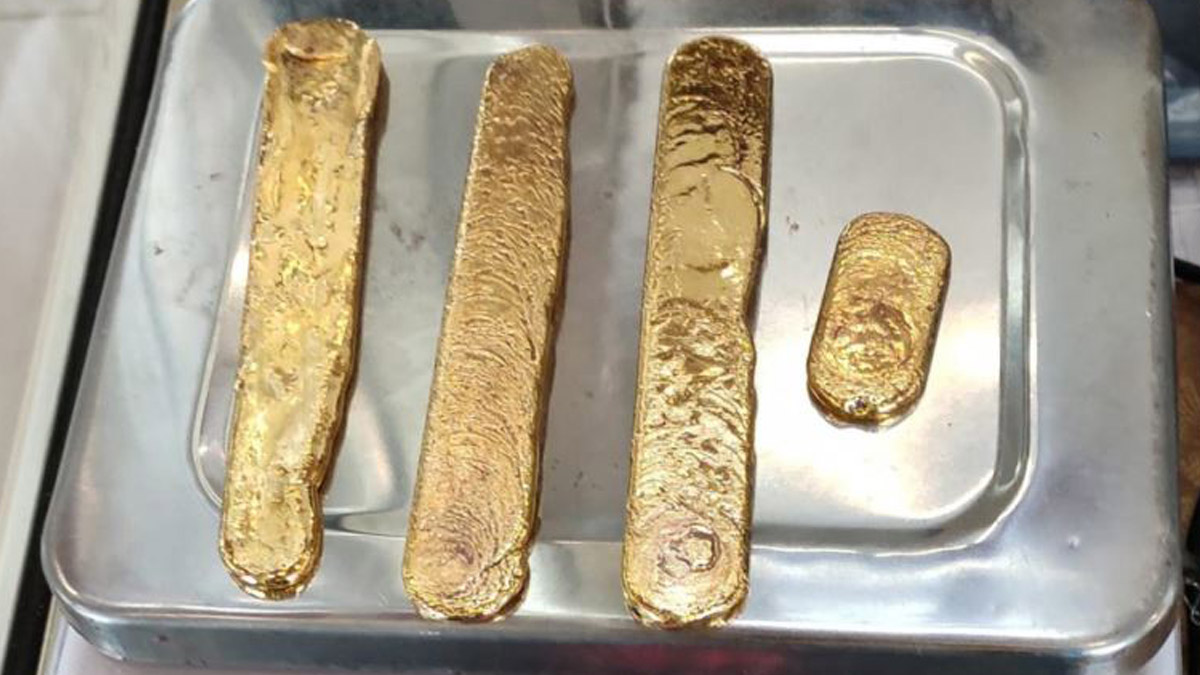 Kalın bağırsağından çıkan altınlar hayrete düşürdü