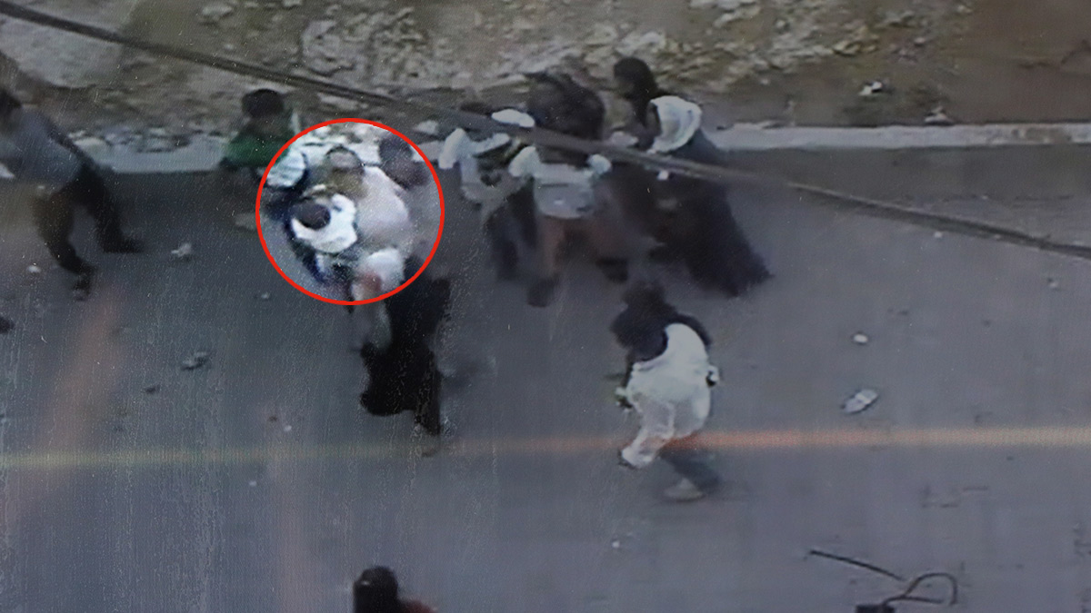 Genç kadın komşularının saldırısına uğradı