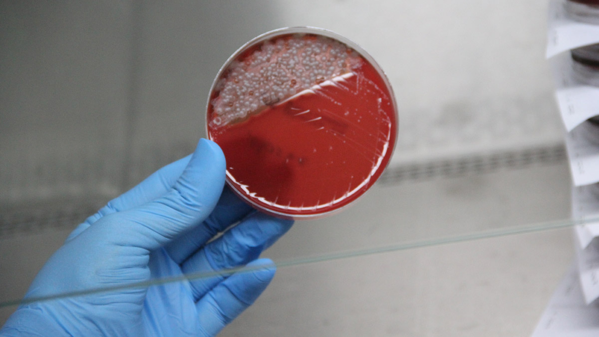 Mikrop saçıyorlar! İşte 1 haftalık maskedeki bakteriler