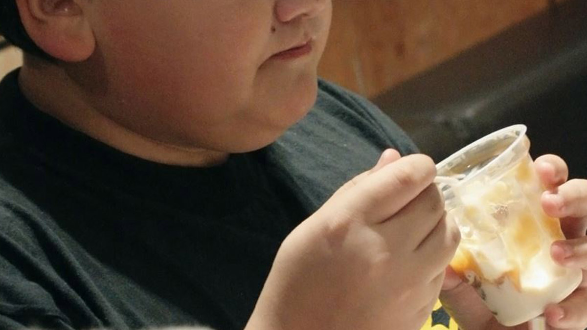 Pandemi çocuklarda obeziteyi artırdı