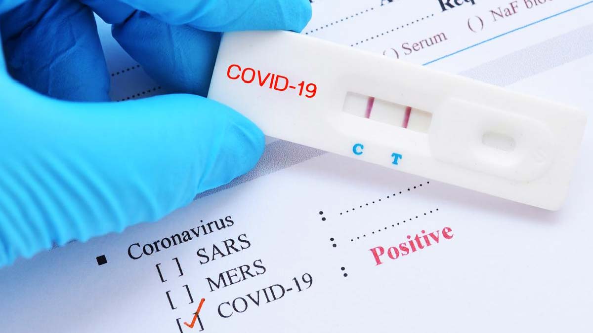 İstanbul'da korkunç tablo! Sadece Zafer Mahallesi'nde 2 bin 200 kişi karantinada