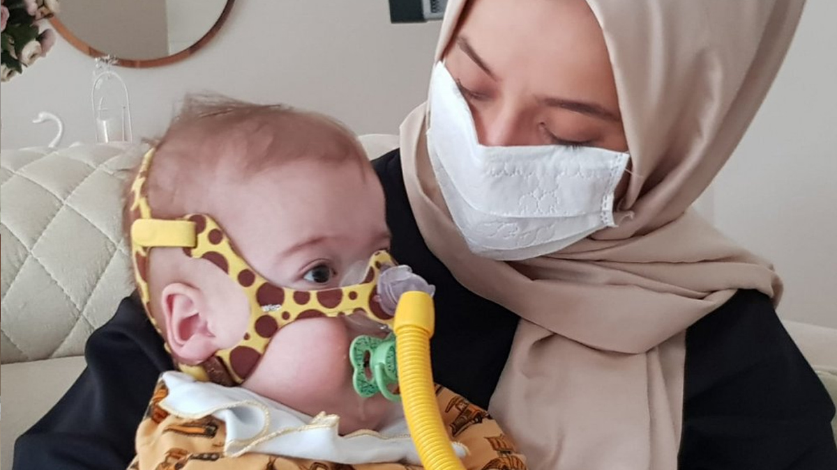 SMA hastası Hamza yardım bekliyor