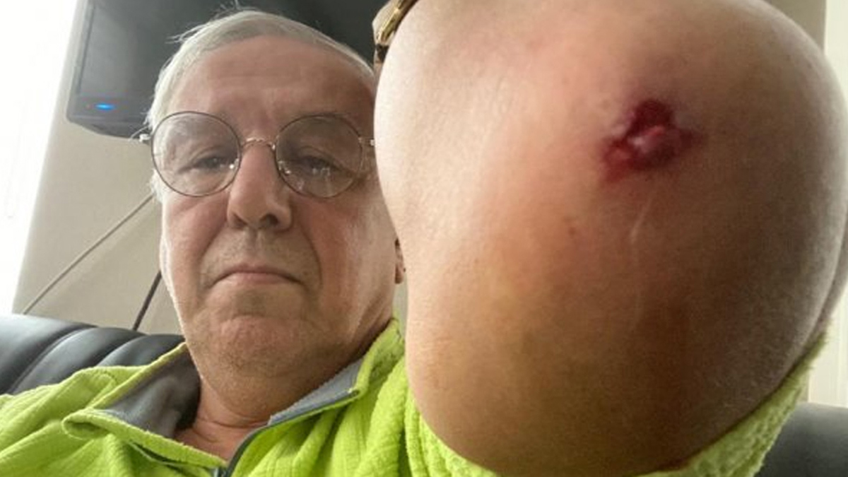 Gazeteci Orhan Uğuroğlu'na saldıranlar serbest bırakıldı