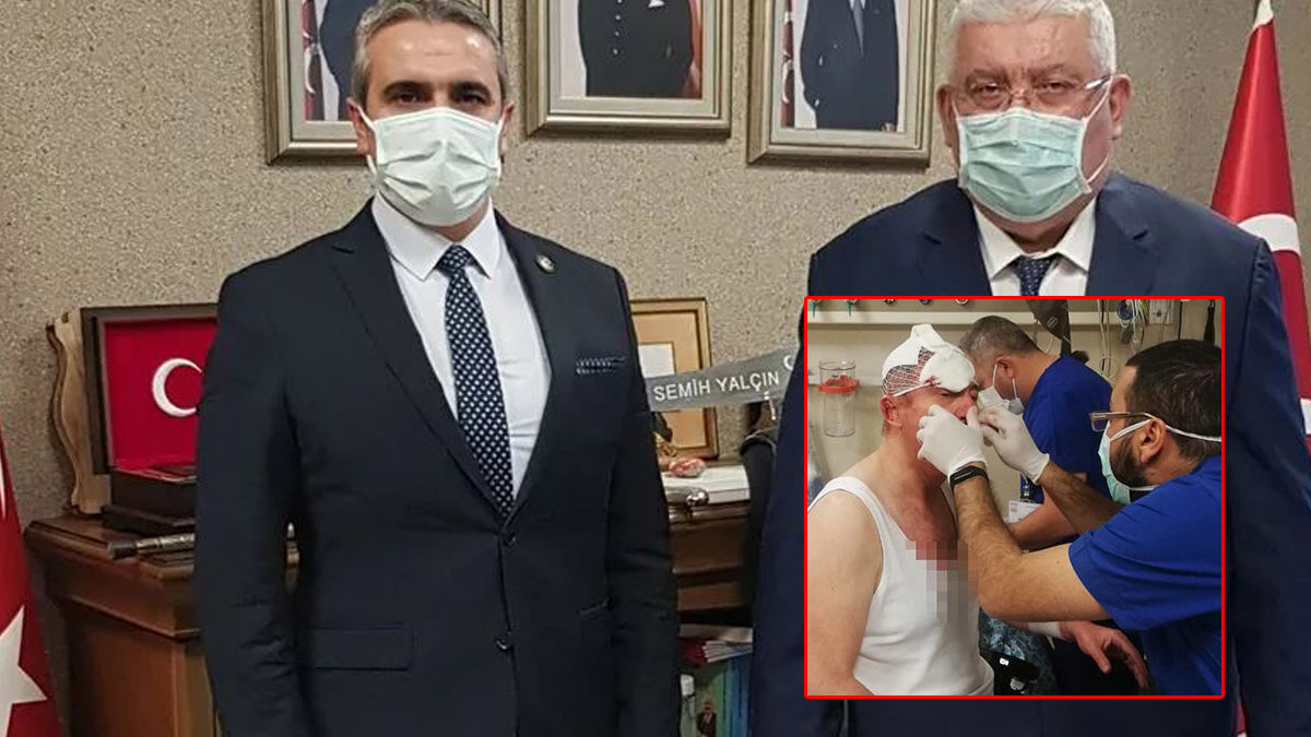 MHP'li İl Başkanı Karapıçak, Özdağ'a yönelik saldırıyı savundu