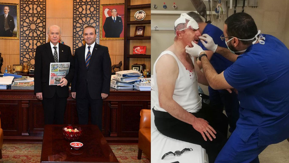 Bahçeli'nin danışmanından tepki çeken yazı: 3 yumruk için ortalığı kaldırıyorlar