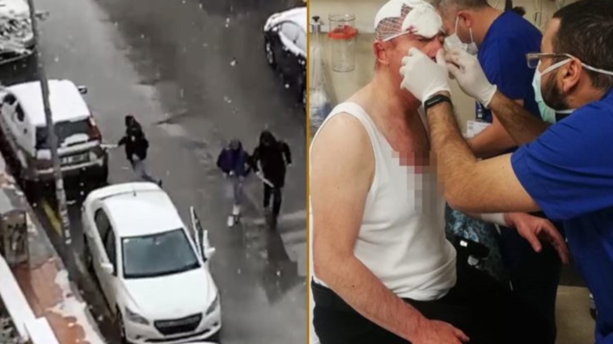 Bu vandallar nasıl serbest?