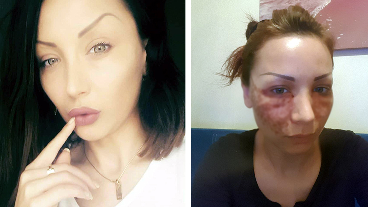 Güzel olmak isterken hayatının 3 senesi silindi!