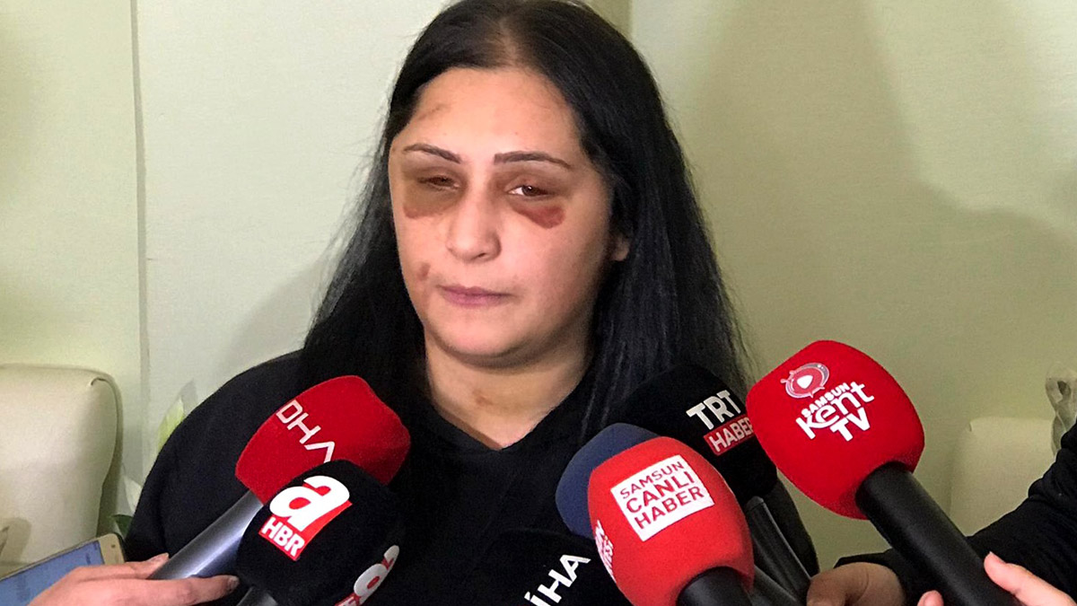 Görüntüler büyük tepki çekmişti: Şiddetin mağduru dehşet anlarını anlattı