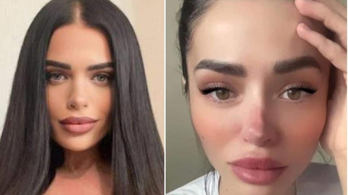 Ünlü televizyon yıldızının burnu düştü