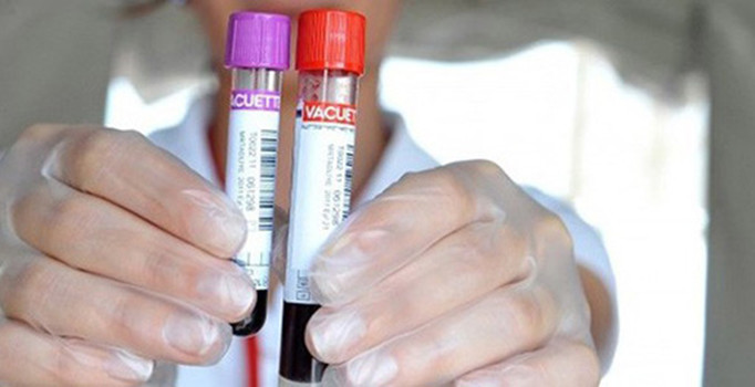 Prof. Dr. Ahmet Özet, hastaya acı veren biyopsinin yapılmayacak