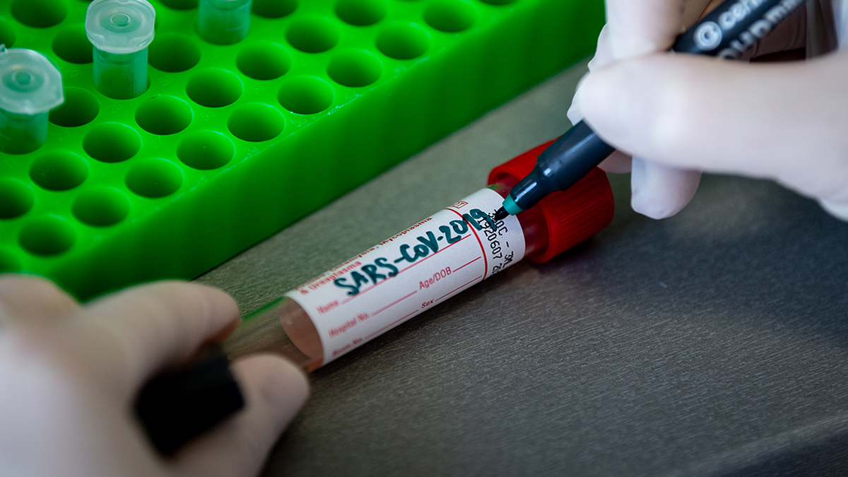 Ankara'da devreye girecek: Tek testle 3 ayrı mutant virüs tespit edilebilecek