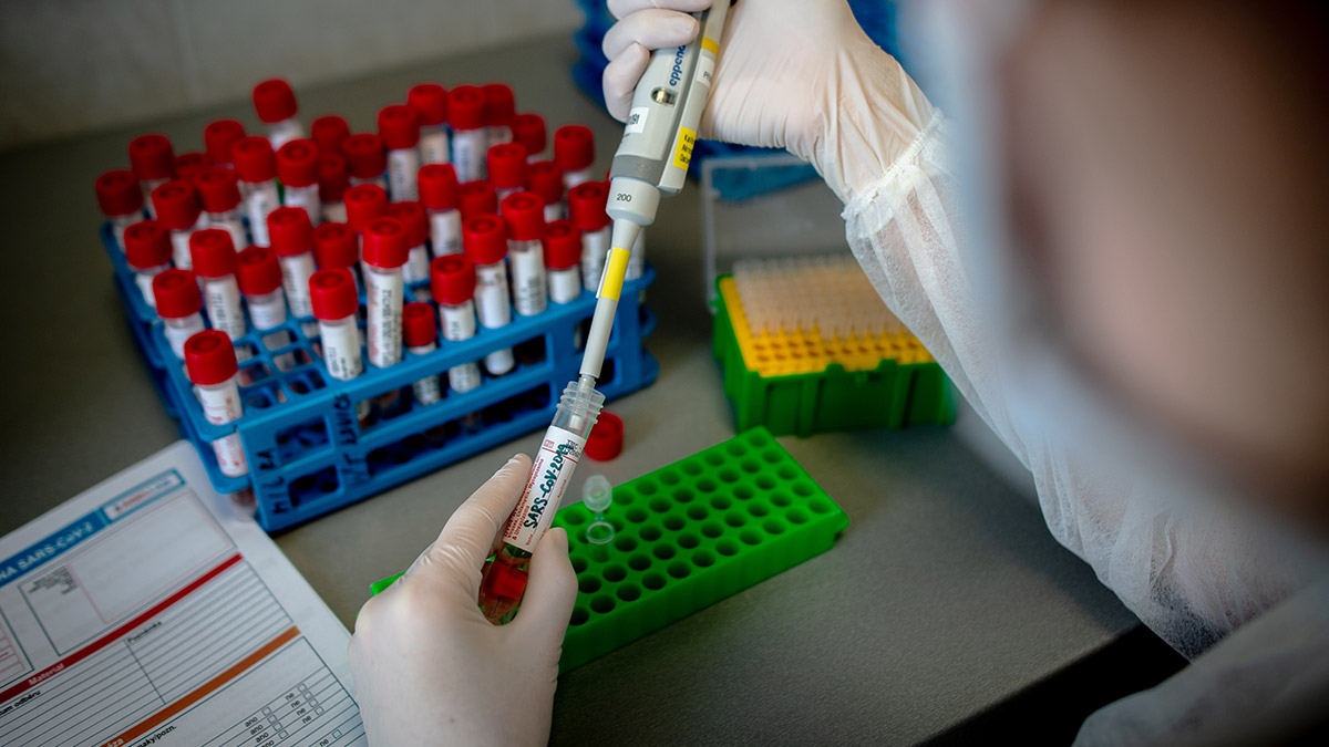 Japonlar araştırdı: İngiliz varyantı orijinal virüse göre daha bulaşıcı