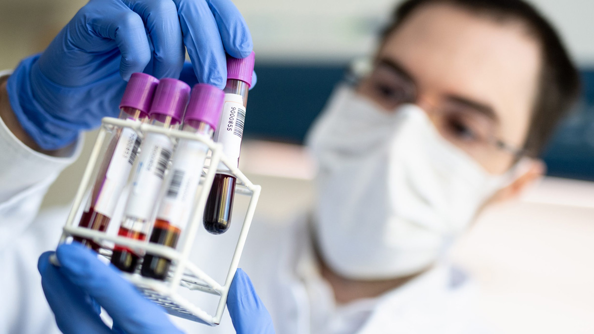 Japon bilim insanları duyurdu: Kovid-19 tedavisinde devrim