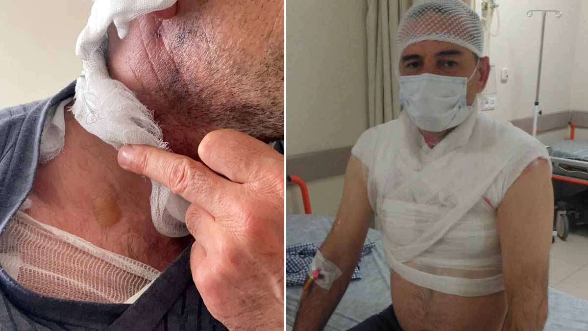 Tartıştığı komşusunun üzerine kaynar su boşalttı