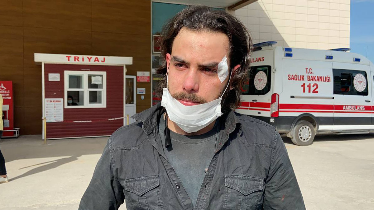 Ödenmeyen maaşını isteyen işçiyi patronu darbetti