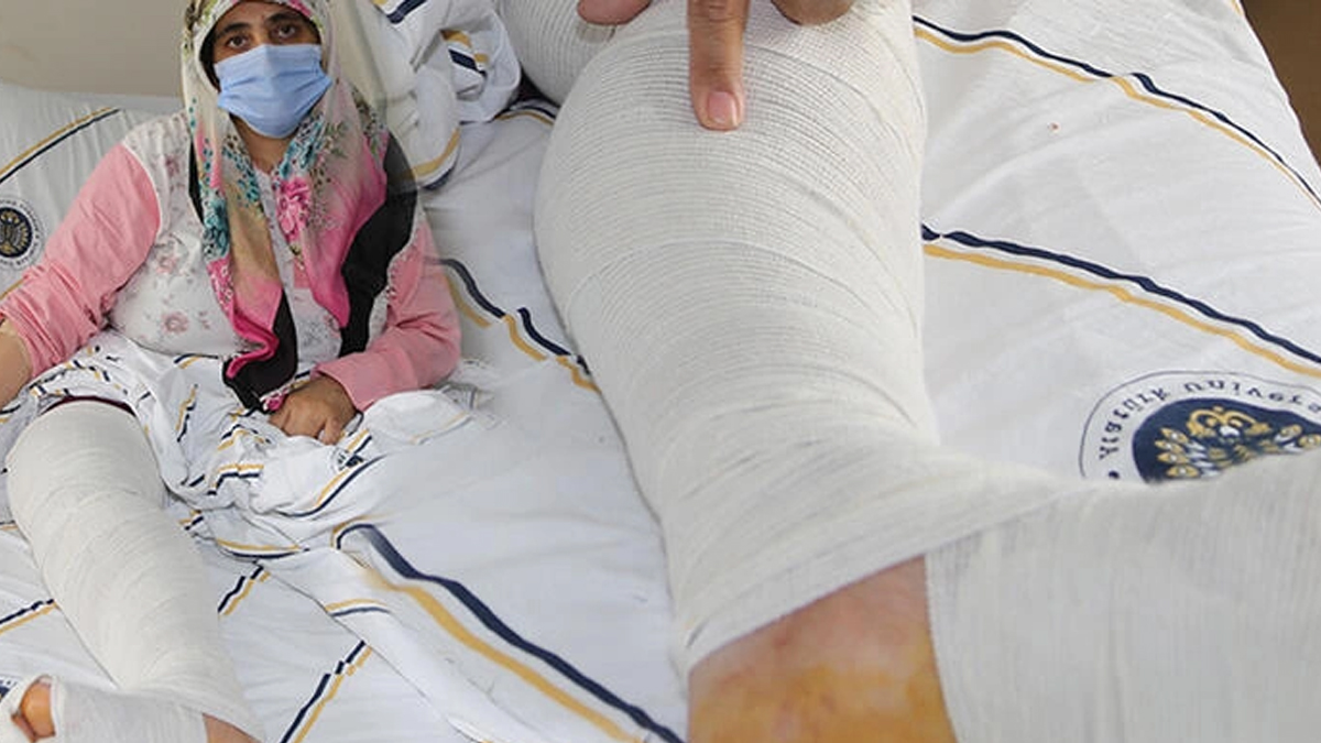 Tam 10 kilo tümörle yaşadı