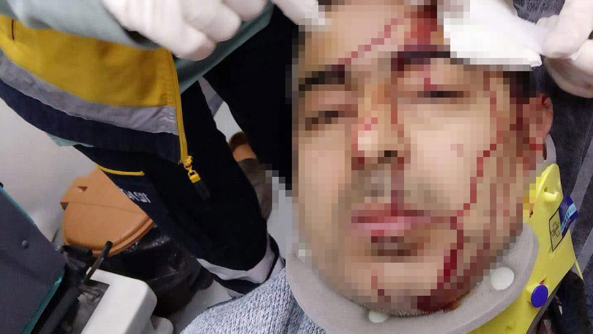 İmam, müezzini tabureyle darbetti