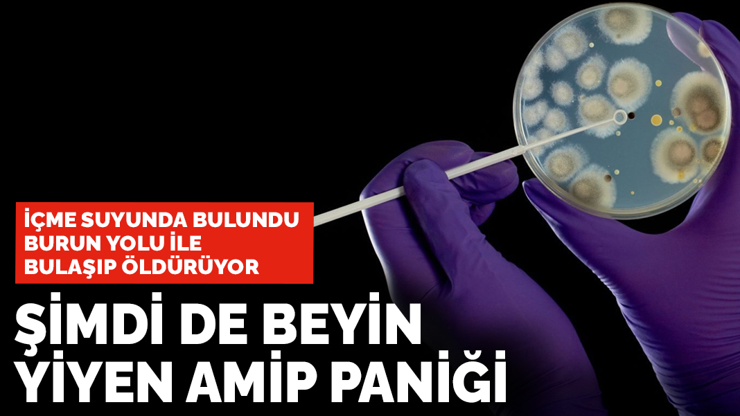 İçme suyunda bulundu: Beyin yiyen amip paniği