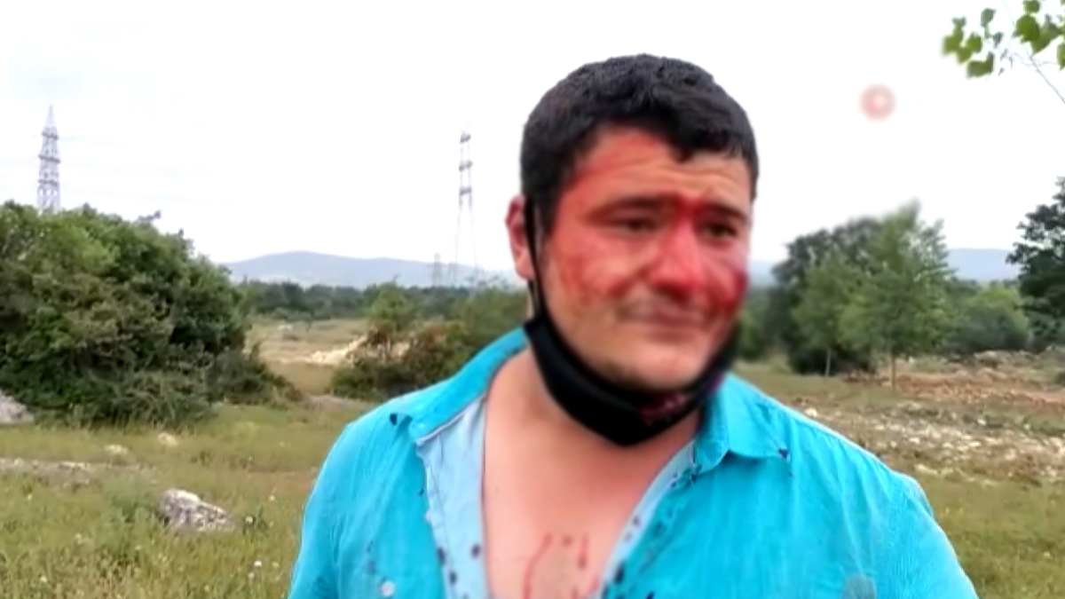 İHA muhabirine saldıran şüphelilerinden biri tutuklandı