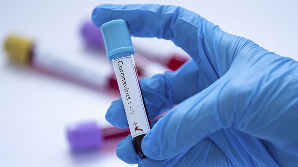 KKTC'de 104 yeni Kovid-19 vakası görüldü