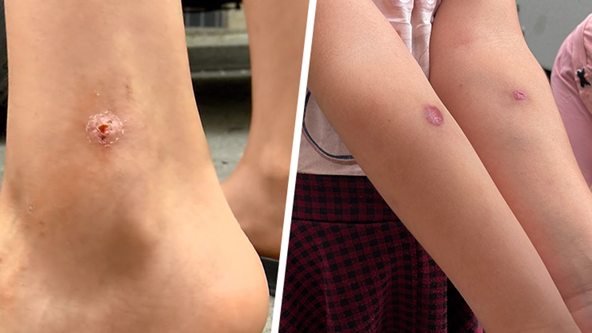 İstanbul sivrisinek istilası altında