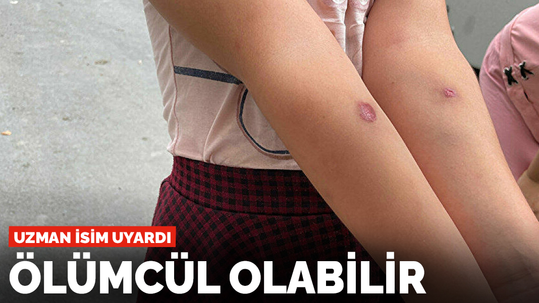 Uzmanlar uyardı! Ölümcül olabilir
