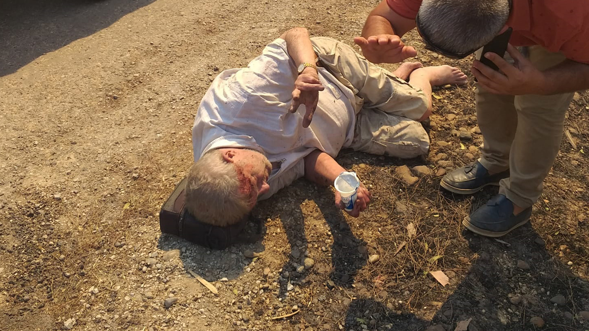 Yanan evinden sürünerek çıktı, yol kenarında bayıldı