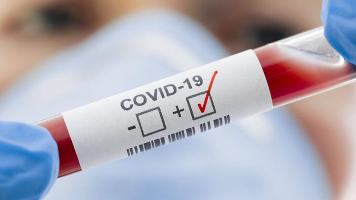 Dünya genelinde Kovid-19 vaka sayısı 200 milyonu aştı