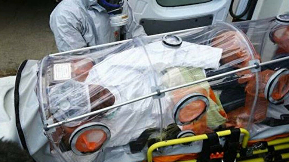 DSÖ açıkladı Marburg Hummasından ilk ölüm gerçekleşti