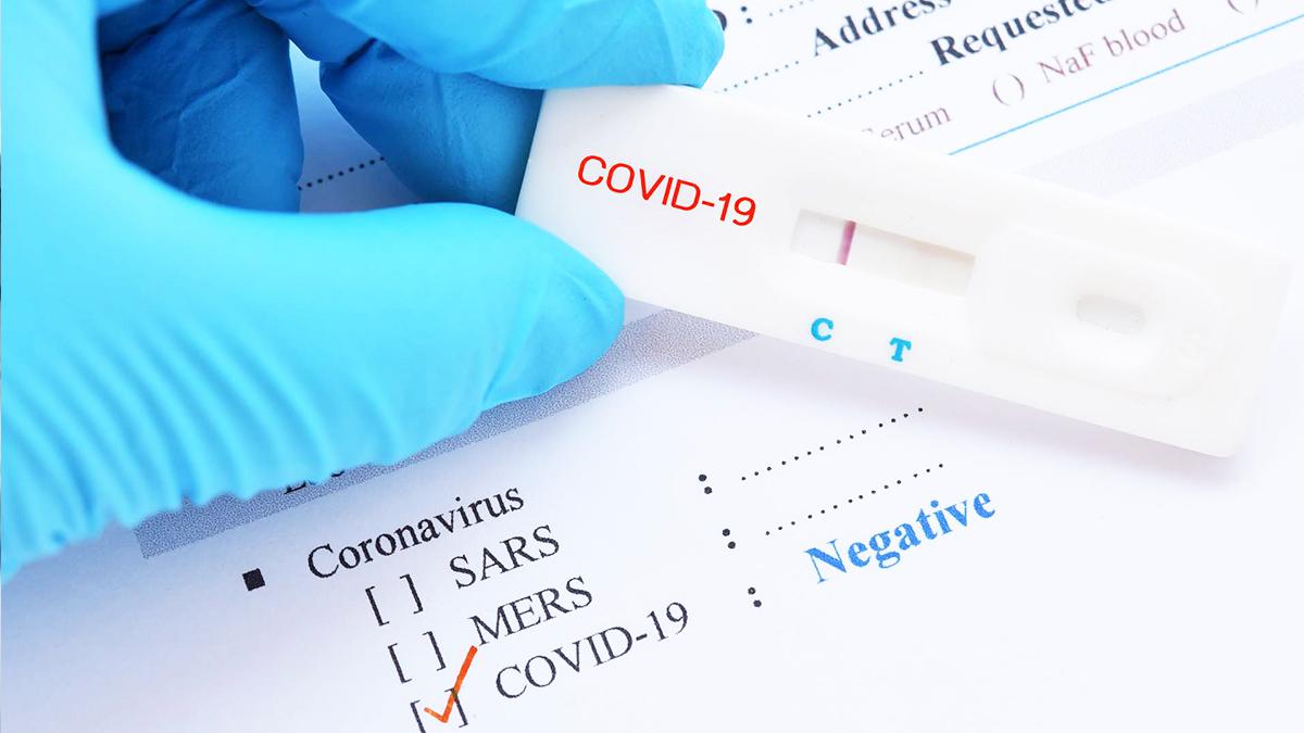 Bilim Kurulu üyesinden rahatlatan açıklama: Varyantlar testlerden kaçamıyor