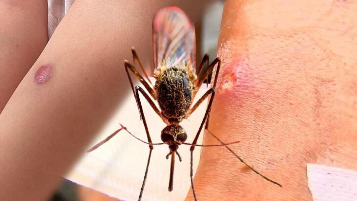 Uzman isim uyardı! 3 ölümcül hastalık riski var