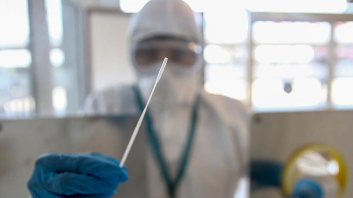 300 TL’ye negatif PCR testi garantisi