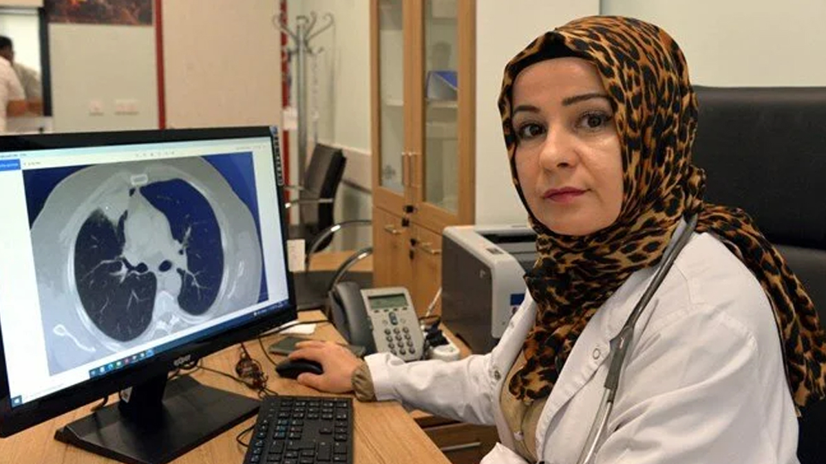 Dünya tıp literatüründe bir ilk! Koronavirüs akciğer kanserini taklit etti