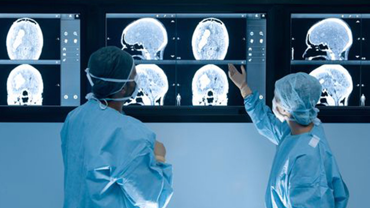 Yeni araştırma: Kovid-19 geçirenlerin beyni küçülüyor