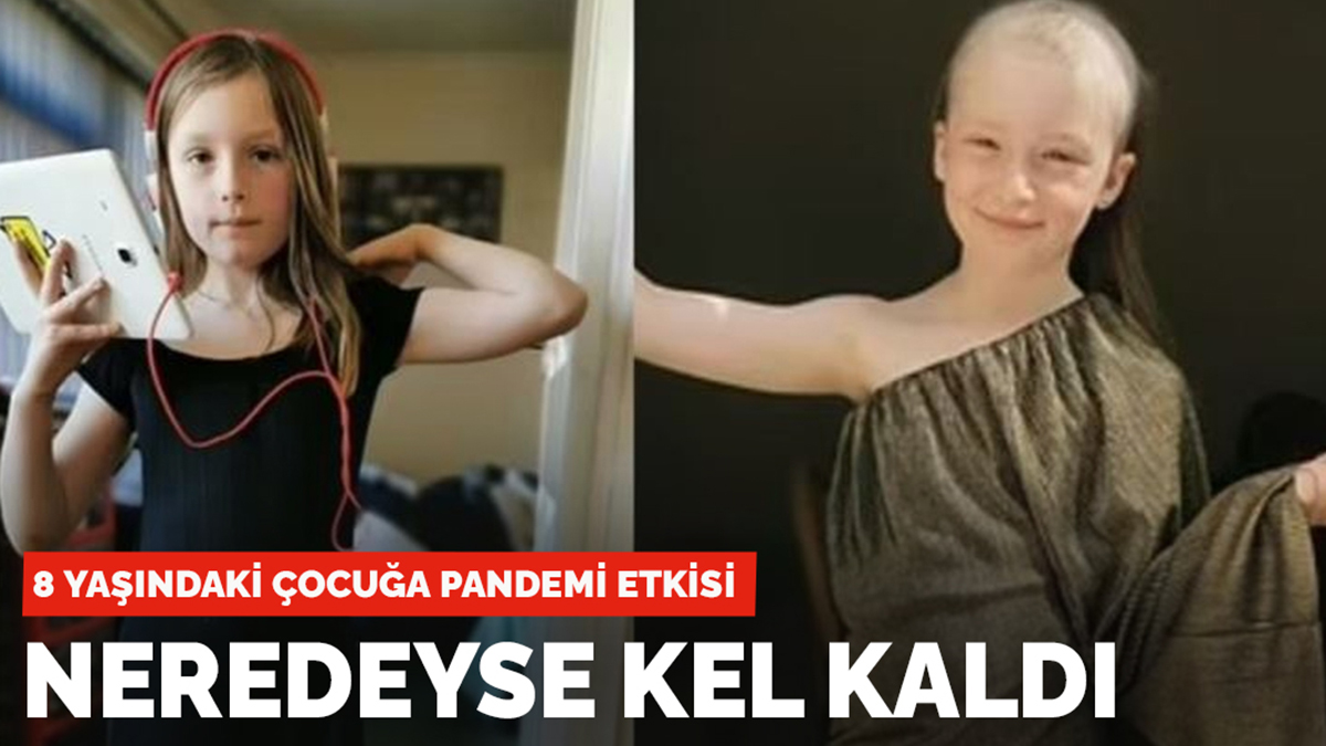 8 yaşındaki çocuğa pandemi etkisi: Neredeyse kel kaldı