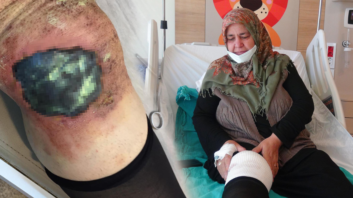 Toz haline getirip dizine koydu, yarım saat sonra kabusu yaşadı