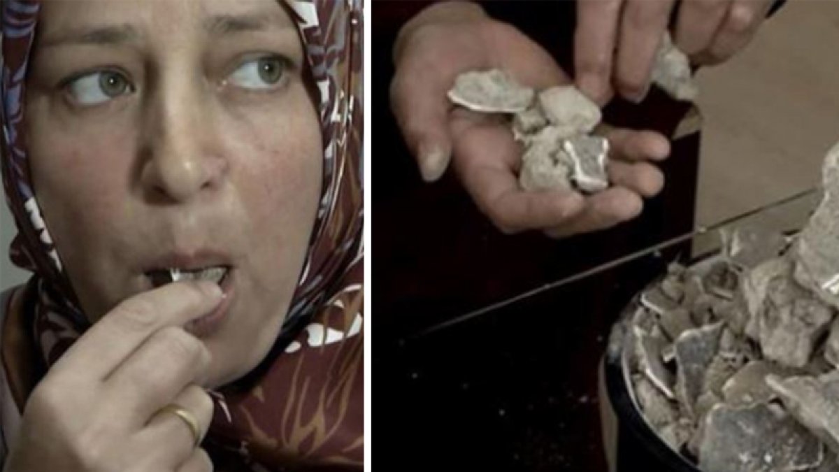 Günde 2 kilo inşaat molozu yiyen kadın görenleri hayrete düşürdü
