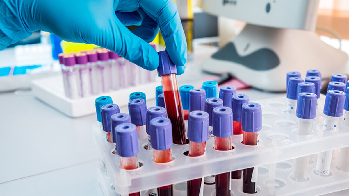 Testler tehlikeye karşı bir hafta önce uyarıyor