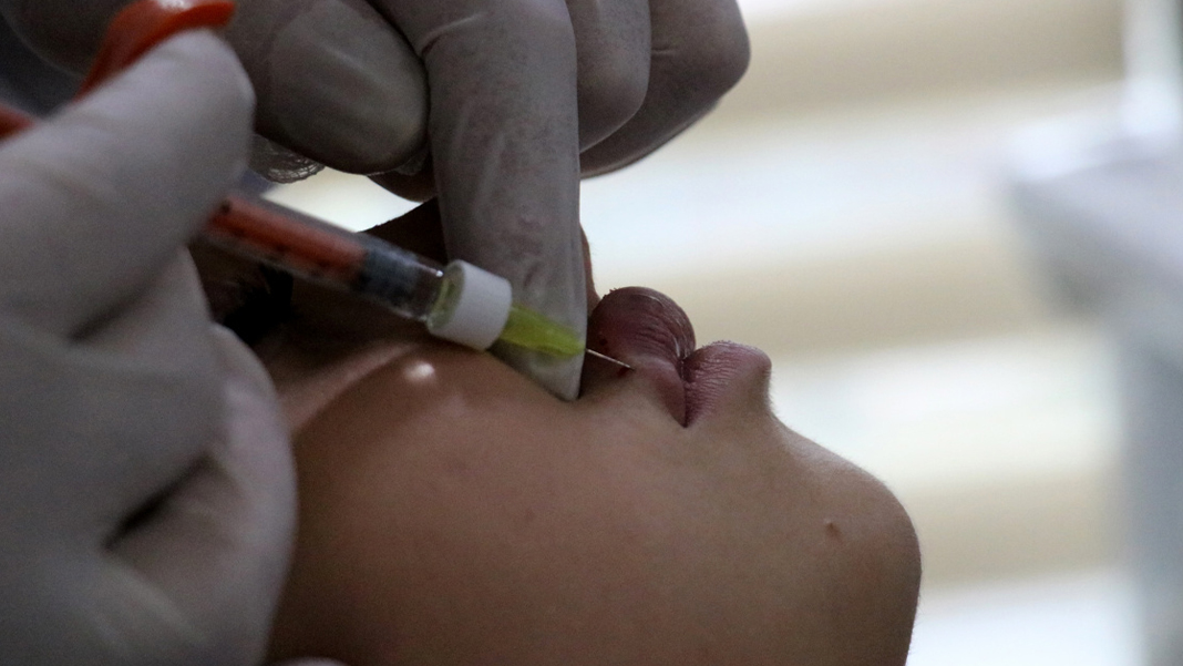 Dudak dolgusu yaptırırken kör olmayın