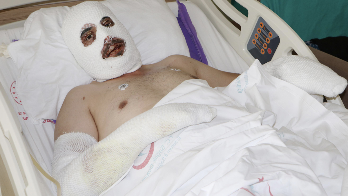 Kafedeki yangından sağ kurtulan adam: Cehennemi yaşadık